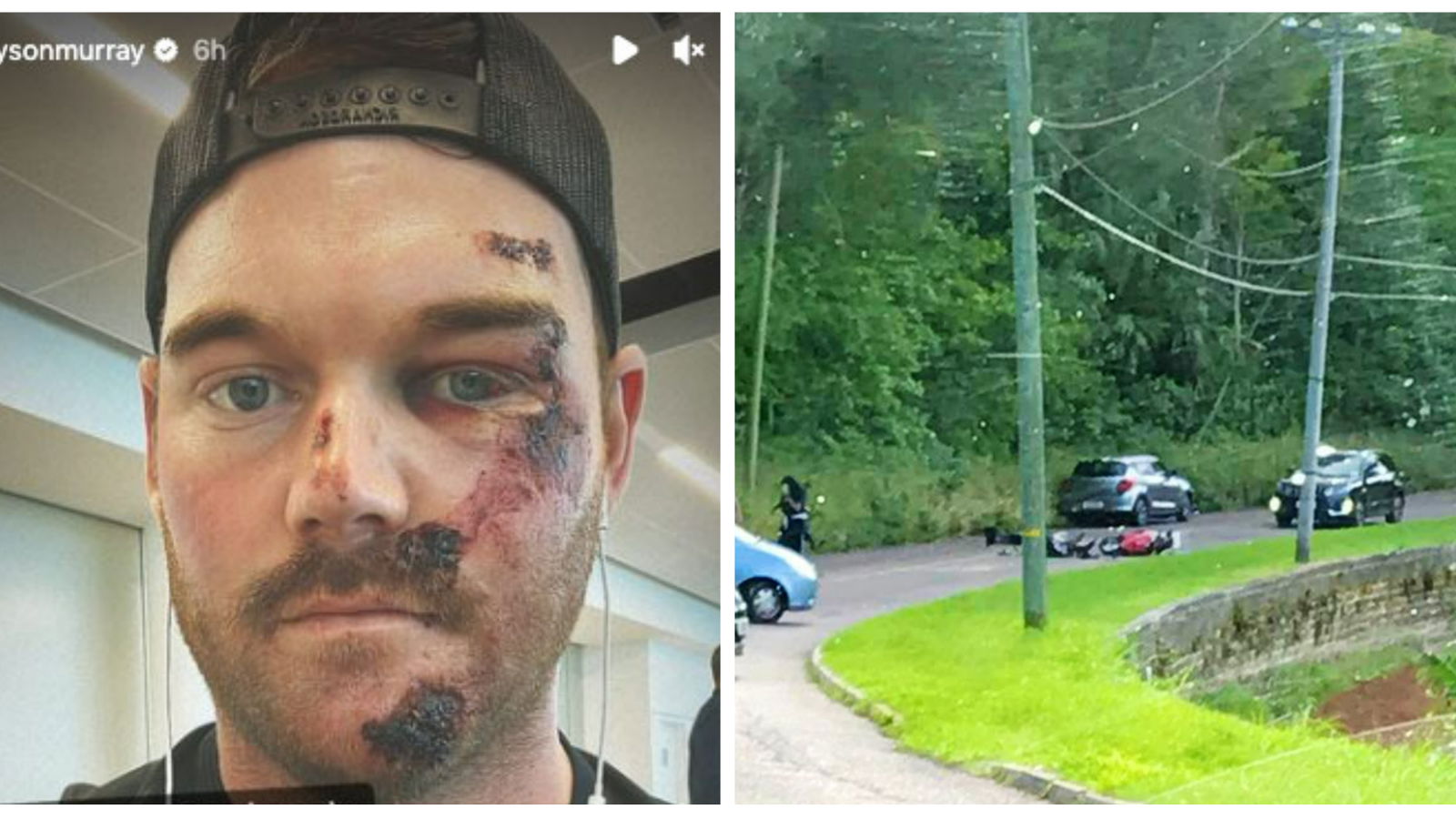 PGA Tour pro shares image of nasty cuts after scooter crash